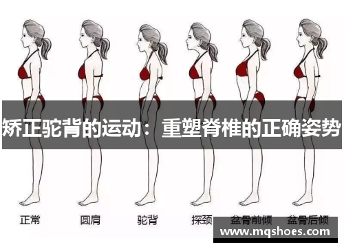 矫正驼背的运动：重塑脊椎的正确姿势
